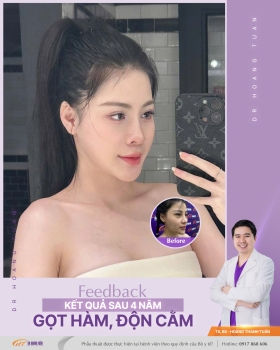ĐỘN CẰM